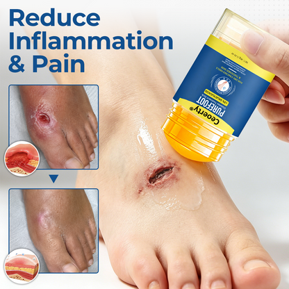 Ceoerty® PureFoot Foot Care Stick 🔥