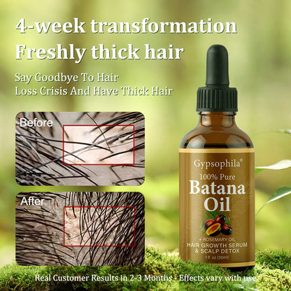 Gypsophila® BATANA OIL FOR HAIR GROWTH