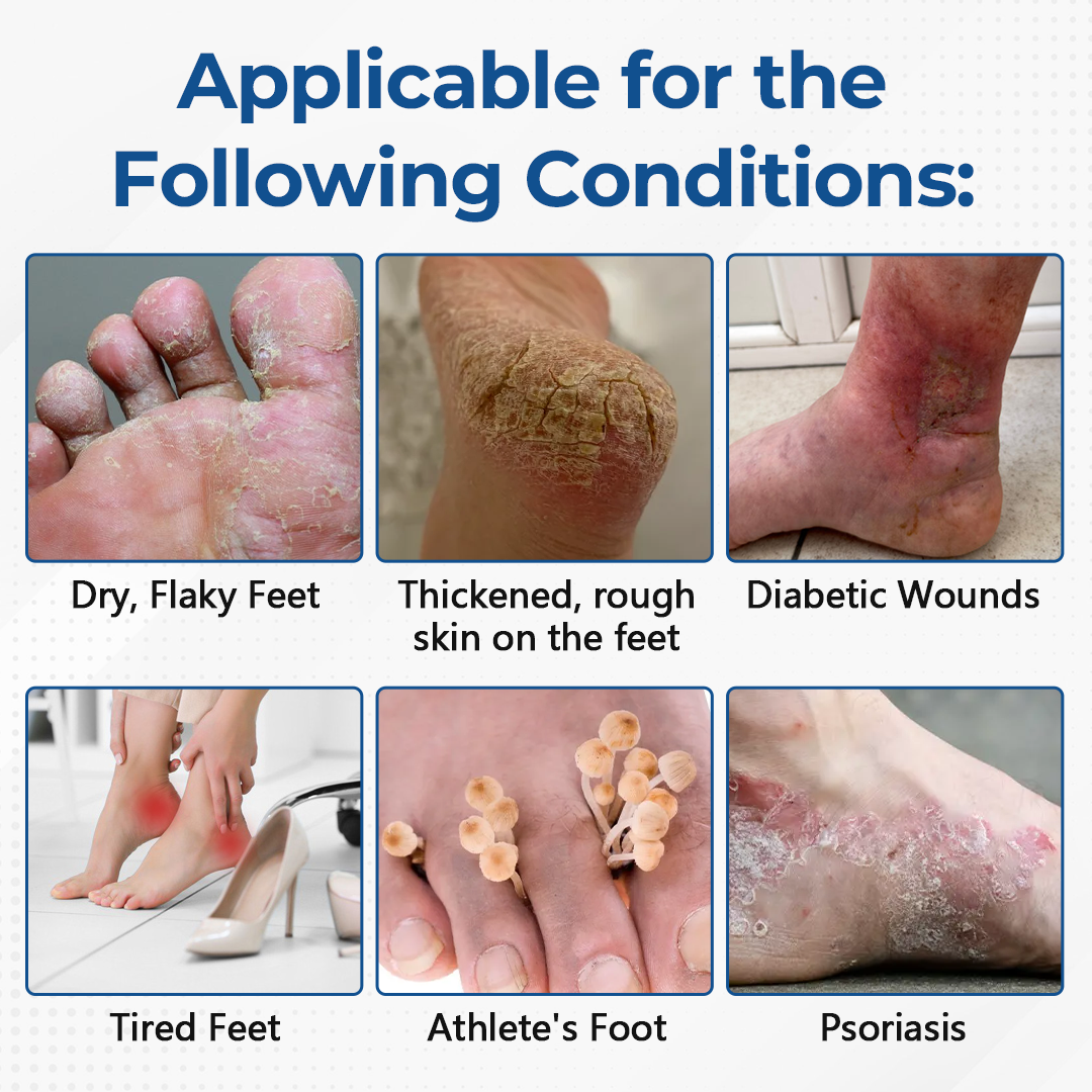 Ceoerty® PureFoot Foot Care Stick 🔥