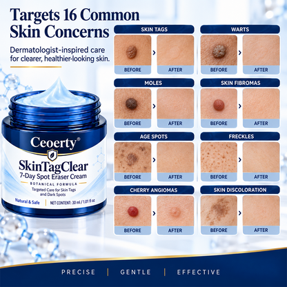 Ceoerty® SkinTagClear 7-Day Spot Eraser Cream