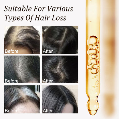 Gypsophila® BATANA OIL FOR HAIR GROWTH