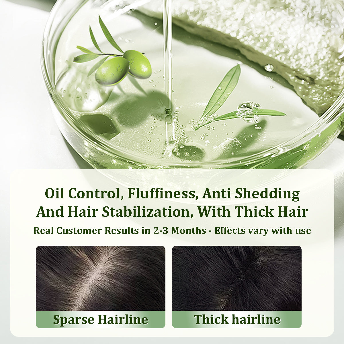 Gypsophila® BATANA OIL FOR HAIR GROWTH