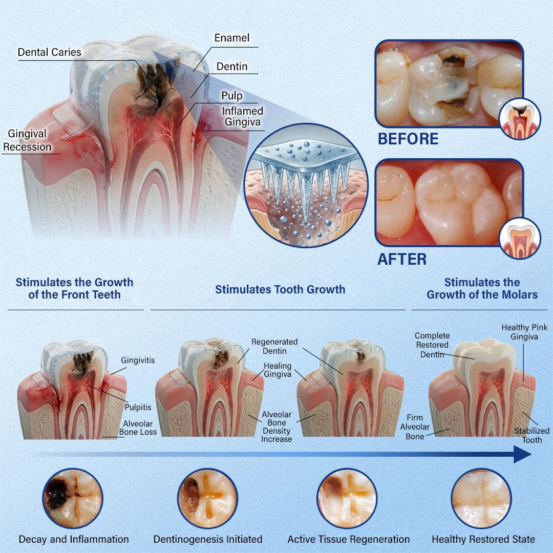 Ceoerty® Tooth & Gum Care Fast-Dissolving Microneedle Patch✨ (𝟓-𝐢𝐧-𝟏 💎 𝐑𝐞𝐛𝐮𝐢𝐥𝐝 𝐄𝐧𝐚𝐦𝐞𝐥 & 𝐃𝐞𝐧𝐭𝐢𝐧 • 𝐒𝐭𝐫𝐞𝐧𝐠𝐭𝐡𝐞𝐧 𝐆𝐮𝐦𝐬 • 𝐄𝐫𝐚𝐝𝐢𝐜𝐚𝐭𝐞 𝐓𝐚𝐫𝐭𝐚𝐫 & 𝐎𝐝𝐨𝐫 • 𝐖𝐡𝐢𝐭𝐞𝐧𝐢𝐧𝐠 • 𝐒𝐭𝐨𝐩 𝐓𝐨𝐨𝐭𝐡 𝐒𝐞𝐧𝐬𝐢𝐭𝐢𝐯𝐢𝐭𝐲)