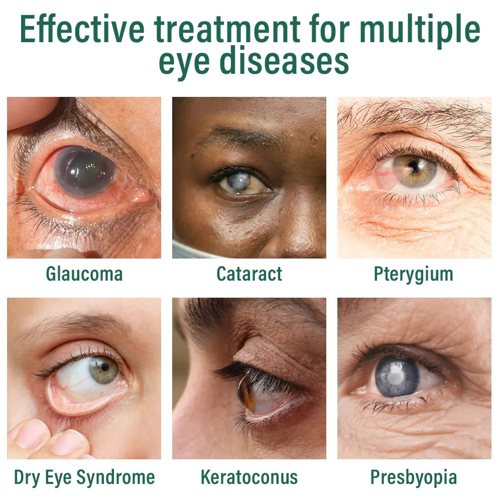 👩‍⚕️Ourlyard® Nano Eye Drops Serum ✅FDA Approved(Suitable for presbyopia, dry eye syndrome, glaucoma, and cataracts) 🌷