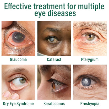 👩‍⚕️Ourlyard® Nano Eye Drops Serum ✅FDA Approved(Suitable for presbyopia, dry eye syndrome, glaucoma, and cataracts) 🌷